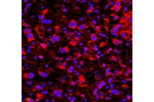 Immunofluorescence (Paraffin-embedded Sections) (IF (p)) image for anti-Endonuclease VIII-Like 1 (NEIL1) antibody (ABIN7073820)