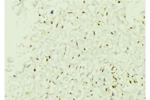 ABIN6274379 at 1/100 staining Mouse muscle tissue by IHC-P. (MAPKAP Kinase 3 antibody  (C-Term))