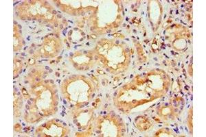 Immunohistochemistry of paraffin-embedded human kidney tissue using ABIN7169428 at dilution of 1:100 (ASH2L antibody  (AA 329-628))
