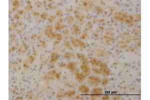 Immunoperoxidase of monoclonal antibody to TTC1 on formalin-fixed paraffin-embedded human liver. (TTC1 antibody  (AA 193-292))