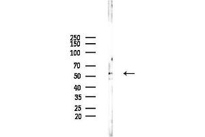 anti-Alkaline Phosphatase, Placental-Like 2 (ALPPL2) (N-Term) antibody