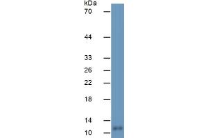 Mouse Capture antibody from the kit in WB with Positive Control:  Human Brain Tissue. (S100B ELISA Kit)