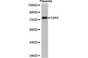 Western Blotting (WB) image for anti-Transporter 2, ATP-Binding Cassette, Sub-Family B (MDR/TAP) (TAP2) antibody (ABIN1875021) (TAP2 antibody)