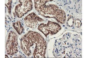 Immunohistochemical staining of paraffin-embedded Human Kidney tissue using anti-PDSS2 mouse monoclonal antibody. (PDSS2 antibody)