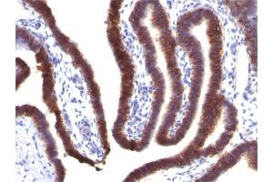 Immunohistochemistry (IHC) image for anti-Epithelial Cell Adhesion Molecule (EPCAM) (AA 77-202), (Extracellular Domain) antibody (ABIN6939978)