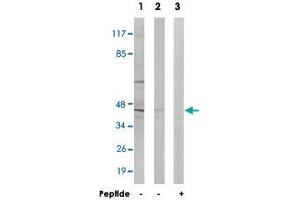 Western blot analysis of extracts from HT-29 cells (Lane 1 and lane 3) and LoVo cells (Lane 2), using ABHD8 polyclonal antibody . (ABHD8 antibody)