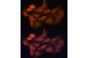 Immunofluorescence analysis of C6 cells using SYCP2 antibody (ABIN7270668) at dilution of 1:100. (SYCP2 antibody  (AA 1231-1530))