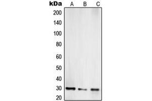Western blot analysis of TOLLIP expression in Jurkat (A), LNCaP (B), HepG2 (C) whole cell lysates. (TOLLIP antibody  (Center))