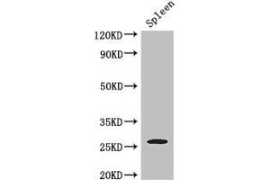 Western Blot Positive WB detected in: Mouse spleen tissue All lanes: ZC4H2 antibody at 3 μg/mL Secondary Goat polyclonal to rabbit IgG at 1/50000 dilution Predicted band size: 27, 16, 24, 21, 26 kDa Observed band size: 27 kDa (ZC4H2 antibody  (AA 1-224))