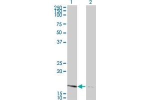 Western Blot analysis of NME2 expression in transfected 293T cell line by NME2 monoclonal antibody (M12), clone 4A7. (NME2 antibody  (AA 1-152))
