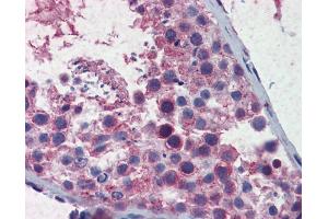 Immunohistochemistry (IHC) image for anti-Structural Maintenance of Chromosomes 3 (SMC3) (C-Term) antibody (ABIN2783035) (SMC3 antibody  (C-Term))
