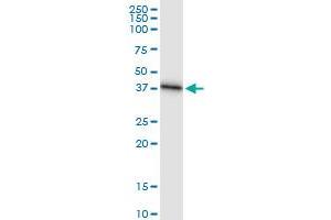 Immunoprecipitation of SRR transfected lysate using anti-SRR MaxPab rabbit polyclonal antibody and Protein A Magnetic Bead , and immunoblotted with SRR MaxPab mouse polyclonal antibody (B01) . (SRR antibody  (AA 1-340))