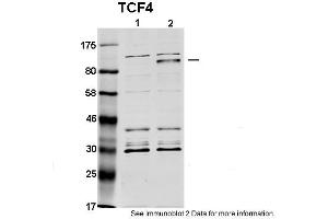 Western Blotting (WB) image for anti-Transcription Factor 4 (TCF4) (N-Term) antibody (ABIN2792580) (TCF4 antibody  (N-Term))