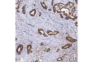 IHC analysis of SCO1 using anti-SCO1 antibody (ABIN7600609). (SCO1 antibody  (AA 21-301))