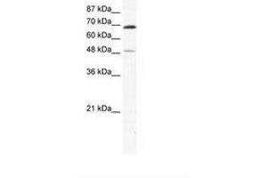 Image no. 1 for anti-Zinc Finger Protein 35 (ZNF35) (AA 33-82) antibody (ABIN6736027)