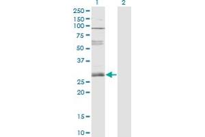 Western Blot analysis of ZNF138 expression in transfected 293T cell line by ZNF138 monoclonal antibody (M01), clone 4D11. (ZNF138 antibody  (AA 151-251))
