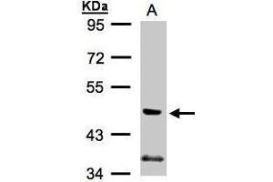 WB Image Sample (30μg whole cell lysate) A:A431, 7. (PIK3R3 antibody  (Center))