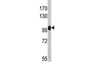 Western blot analysis of anti-NLRP12 antibody and HL-60 lysate (NLRP12 antibody)