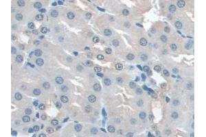 Immunohistochemistry (IHC) image for anti-Interleukin 22 Receptor, alpha 2 (IL22RA2) (AA 31-223) antibody (ABIN7435862)