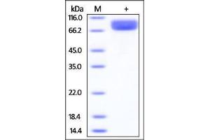 SDS-PAGE (SDS) image for Interleukin 13 Receptor, alpha 1 (IL13RA1) (AA 26-340) protein (Fc Tag) (ABIN2181338) (IL13 Receptor alpha 1 Protein (AA 26-340) (Fc Tag))