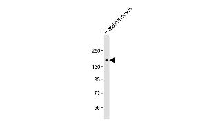 Anti-AGL Antibody (M15) at 1:1000 dilution + human skeletal muscle lysate Lysates/proteins at 20 μg per lane. (AGL antibody  (N-Term))