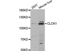 Western blot analysis of extracts of various cell lines, using CLCN1 antibody (ABIN5973365) at 1/1000 dilution. (CLCN1 antibody)