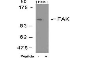 Image no. 3 for anti-PTK2 Protein tyrosine Kinase 2 (PTK2) (Tyr925) antibody (ABIN197348) (FAK antibody  (Tyr925))