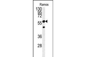 Western blot analysis in Ramos cell line lysates (15ug/lane). (PHGDH antibody  (AA 249-277))