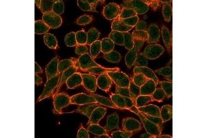 Immunofluorescence analysis of PFA-fixed HeLa cells. (MEF2B antibody)