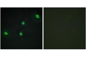 Immunofluorescence analysis of HepG2 cells, using CDCA4 Antibody. (CDCA4 antibody  (AA 121-170))