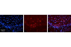Rabbit Anti-ID2 Antibody   Formalin Fixed Paraffin Embedded Tissue: Human Liver Tissue Observed Staining: Nucleus in hepatocytes Primary Antibody Concentration: 1:100 Other Working Concentrations: N/A Secondary Antibody: Donkey anti-Rabbit-Cy3 Secondary Antibody Concentration: 1:200 Magnification: 20X Exposure Time: 0. (Id2 antibody  (Middle Region))