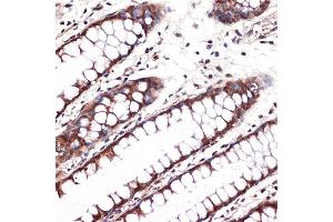 Immunohistochemistry of paraffin-embedded human colon using Carbonic Anhydrase 2 (C) Rabbit mAb (ABIN7266070) at dilution of 1:100 (40x lens). (CA2 antibody)