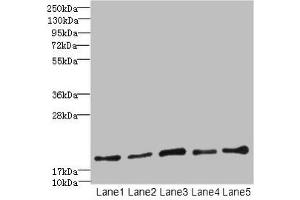 Western blot All lanes: PPIL3 antibody at 10 μg/mL Lane 1: U87 whole cell lysate Lane 2: HL60 whole cell lysate Lane 3: K562 whole cell lysate Lane 4: THP-1 whole cell lysate Lane 5: A549 whole cell lysate Secondary Goat polyclonal to rabbit IgG at 1/10000 dilution Predicted band size: 19 kDa Observed band size: 19 kDa (PPIL3 antibody  (AA 2-161))