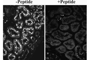 ABIN5539614 (0. (SLC26A6 antibody  (Internal Region))