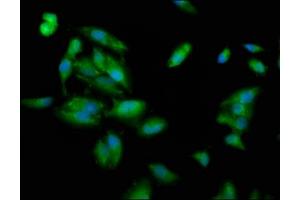 Immunofluorescence staining of Hela cells with ABIN7163687 at 1:100, counter-stained with DAPI. (PLEC antibody  (AA 1744-1929))