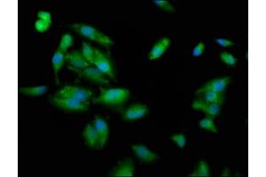 Immunofluorescence staining of Hela cells with ABIN7163687 at 1:100, counter-stained with DAPI. (PLEC antibody  (AA 1744-1929))