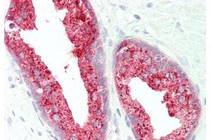 Rabbit Anti-ACPP antibody  Formalin Fixed Paraffin Embedded Tissue: Human Prostate Primary antibody Concentration: 1:100 Secondary Antibody: Donkey anti-Rabbit-Cy3 Secondary Antibody Concentration: 1:200 Magnification: 20x Exposure Time: 0. (ACPP antibody  (Middle Region))