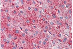 Human Liver (formalin-fixed, paraffin-embedded) stained with APOC3 antibody ABIN462267 followed by biotinylated anti-goat IgG secondary antibody ABIN481715, alkaline phosphatase-streptavidin and chromogen. (APOC3 antibody)