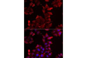 Immunofluorescence analysis of U2OS cells using PDLIM1 antibody. (PDLIM1 antibody  (AA 1-329))