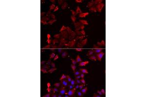 Immunofluorescence analysis of U2OS cells using PDLIM1 antibody. (PDLIM1 antibody  (AA 1-329))