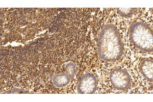Immunohistochemistry (IHC) image for anti-Interleukin 17 (IL17) (AA 21-153) antibody (ABIN7427654)