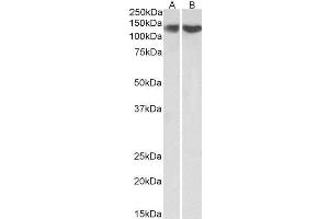 ABIN4902753 (0. (REST antibody)
