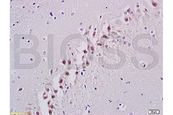 ANP32C antibody  (AA 81-180)