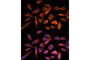 Immunofluorescence analysis of HeLa cells using ACLY Rabbit pAb (ABIN7265716) at dilution of 1:250 (40x lens). (ACLY antibody  (AA 752-1101))