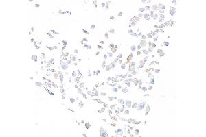 Immunocytochemistry (ICC) image for anti-Dipeptidyl-Peptidase 4 (DPP4) (AA 29-766) antibody (ABIN7795690)