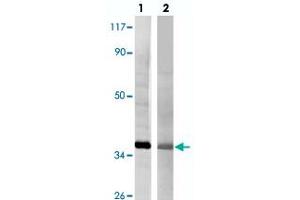 Western blot analysis of HeLa cell lysate (lane 1) and rat liver (lane 2) tissue lysate with GAPDH polyclonal antibody  at 1:10000 dilution. (GAPDH antibody)