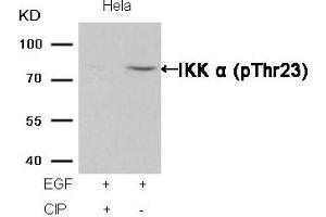 Western blot analysis of extracts from Hela cells, treated with EGF or calf intestinal phosphatase (CIP), using IKK α (Phospho-Thr23) Antibody. (IKK alpha antibody  (pThr23))