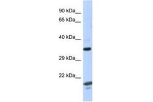 Image no. 1 for anti-rho GTPase Activating Protein 2 (ARHGAP2) (AA 229-278) antibody (ABIN6747618) (CHN1 antibody  (AA 229-278))