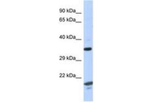 Image no. 1 for anti-rho GTPase Activating Protein 2 (ARHGAP2) (AA 229-278) antibody (ABIN6747618)