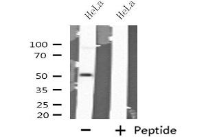 Western blot analysis of extracts from HeLa cells using GABRA6 antibody. (GABRA6 antibody  (N-Term))